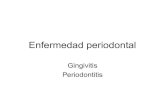 Tema m28 enfermedad_periodontal_periodontitis