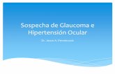 Sospecha de glaucoma e hipertensión ocular