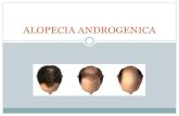 Alopecia androgenica