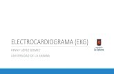 Electrocardiograma EKG