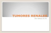 Radiología de los tumores renales