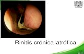 Rinitis crónica atrófica y rinoscleroma
