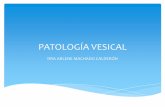 Patología Vesical por Ultrasonido