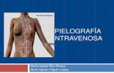 Pielografía y urografía