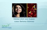 Selena Gómez sufre lupus, qué es y síntomas...