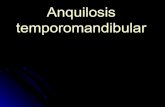 Anquilosis temporomandibular