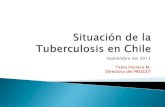 Tuberculosis en Chile