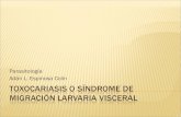 Toxocariasis o sindrome de migración larvaria visceral