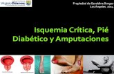 Isquemia critica, Pié Diabético y Amputaciones