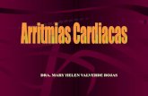3. arritmias cardiacas