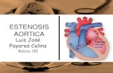 Estenosis aortica - LUISJOMD