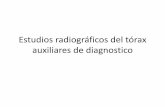Estudios radiográficos del tórax