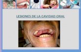 Lesiones de la cavidad oral