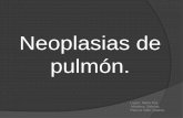 Neoplasias de pulmón.