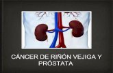 Cáncer de riñón vejiga y próstata