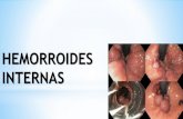 Hemorroides internas