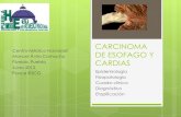 Carcinoma de Esofago y Cardias