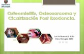 Osteomielitis, Osteosarcoma y Cicatrización Post- Exodoncia.