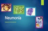 Neumonía pneumocystis