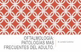 Oftalmología  patologías mas frecuentes en el adulto