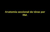 4.4 anatomía seccional de tórax por rm