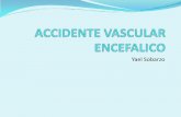 Accidente vascular encefalico
