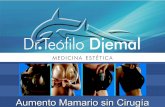 Aumento de Mamas sin Cirugía, Breast enhancement without surgery:   Teófilo Djemal Medicina Estética