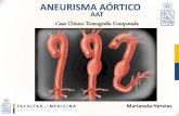 Diagnóstico de Aneurisma Aórtico Torácico (AAT) por TC