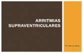 Arritmias Supraventriculares - Dr. Bosio