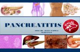 Pancreatitis aguda en cirugia