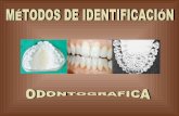 MéTodos De IdentificacióN Odontografica