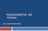 Semiologia Radiológica de Torax