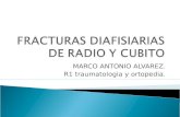 Fracturas diafisiarias radio y cubito.