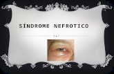 Síndrome nefrótico