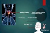 Glandula tiroides 29 01-14