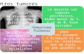 Otros tumores