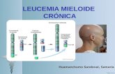 Leucemia mieloide crónica- Samaria huamanchumo Sandoval