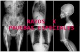 historia de los Rayos  x, estudios especiales