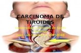 Carcinoma de tiroides