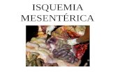 Isquemia mesenterica