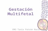 Gestación multifetal