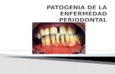 Patogenia de la enfermedad periodontal
