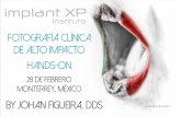 Fotografía Clínica de Alto Impacto Dr. Johan Figueira & Implant XP