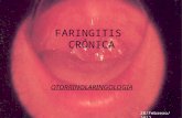 Faringitis cronica