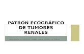 Patron ecograficos de tumores renales