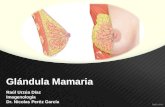 Glandula mamaria Radiología