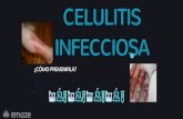 Celulitis Infecciosa