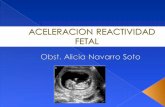 Aceleracion reactividad fetal