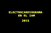 Electrocardiograma en IAM 2015