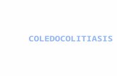 Coledocolitiasis 2015